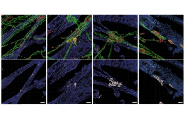 Representative 3D reconstruction images of human neuromuscular junctions