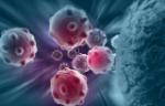 Cancer cells. Credit: istock.com/vitanovski