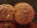 Pancreatic cancer cells CC BY-NC Credit Anne Weston, Francis Crick Institute