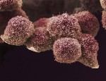 Pancreatic cancer cells grown in culture, SEM. Credit: Anne Weston, Francis Crick Institute. Attribution-NonCommercial 4.0 International (CC BY-NC 4.0)