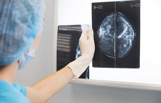 Breast screening