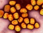 Colourised transmission electron micrograph of monkeypox virus particles (gold) cultivated and purified from cell culture. Image captured at the NIAID Integrated Research Facility (IRF) in Fort Detrick, Maryland. Credit: NIAID