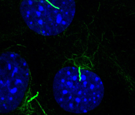 Primary cilia 