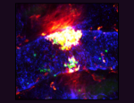 Image:  A Portrait of a Fiery Blood Clot, Credit: Sammy El-Mansi, Queen Mary University of London, British Heart Foundation - Reflections of Research
