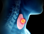 Thyroid Illustration