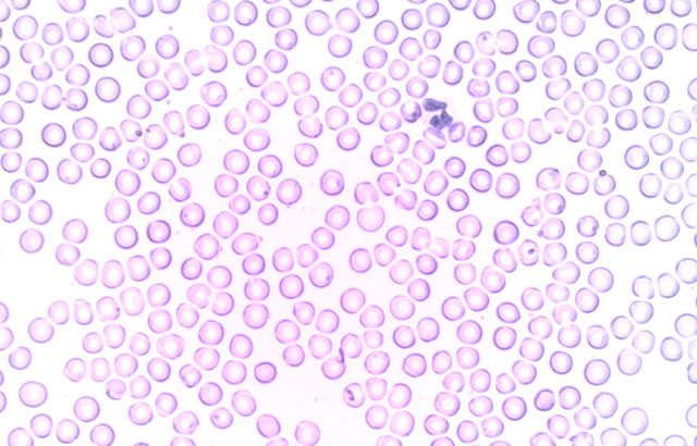 White blood cell packages